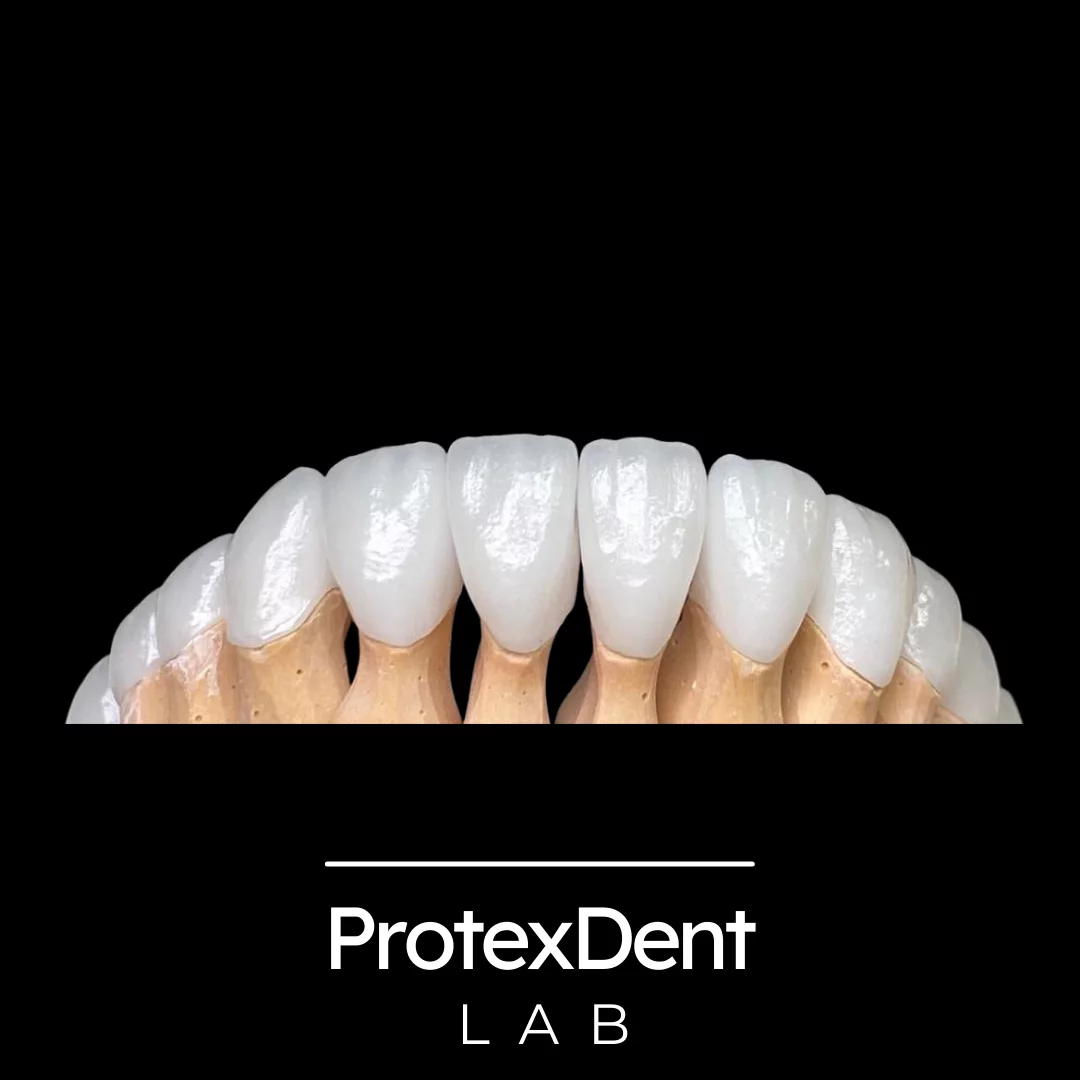 Licówki porcelanowe – protetyka Gorlice